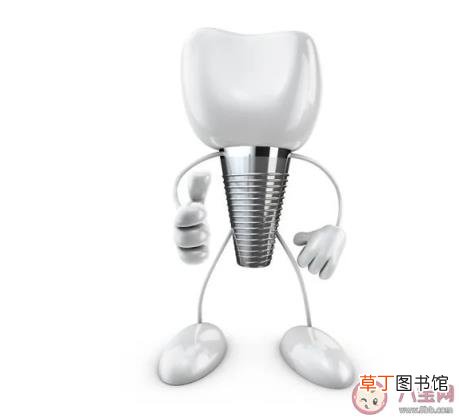 种植牙的优点好处是什么 为什么种植牙那么贵