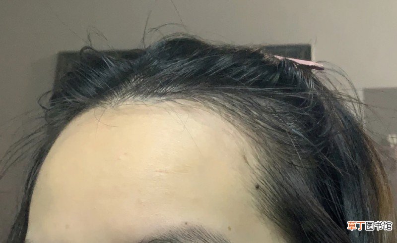 发际线高的人为啥帅