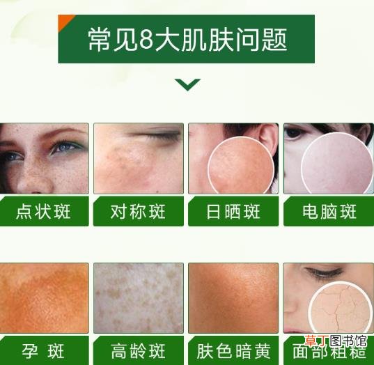 祛雀斑最有效的方法