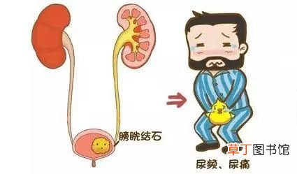 尿频的症状 尿频症状分析