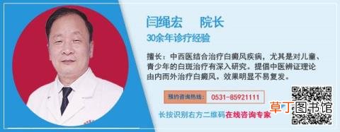 自癜风多久会停止扩散 白癜风为什么扩散