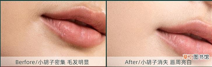 女生唇毛刮掉会越来越浓吗