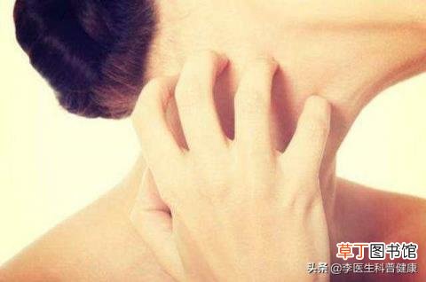 为什么荨麻疹睡着了发作 为什么荨麻疹晚上发作