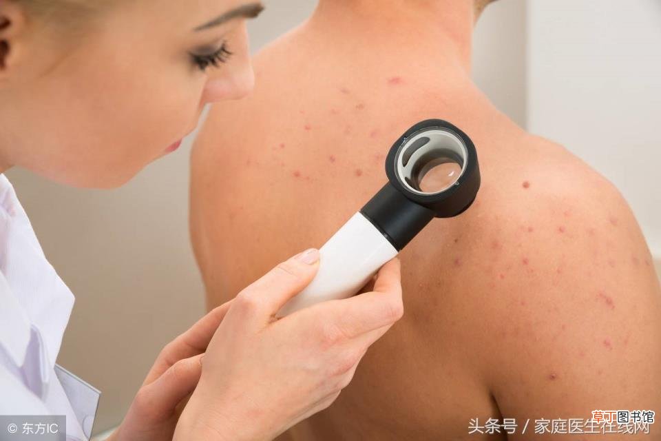 右边背上长痘痘是什么原因 为什么后背长痘