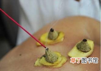 灸完艾灸后会发痒 为什么艾灸痒