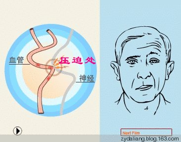眼皮跳动频繁是什么原因引起的 为什么眼皮跳个不停