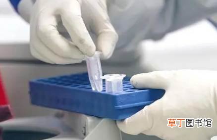 春运回家做核酸检查提前几天做好 2022春运跨省需要核酸检测证明吗