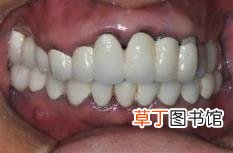 王者荣耀排位一直输气死了 排位为什么一直输