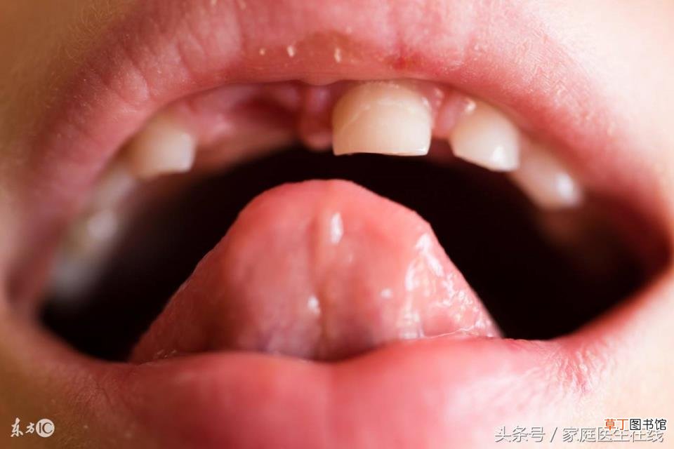 女娲造人总结20字 精卫为什么填海