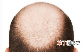 梦见自己头发快掉秃了什么意思