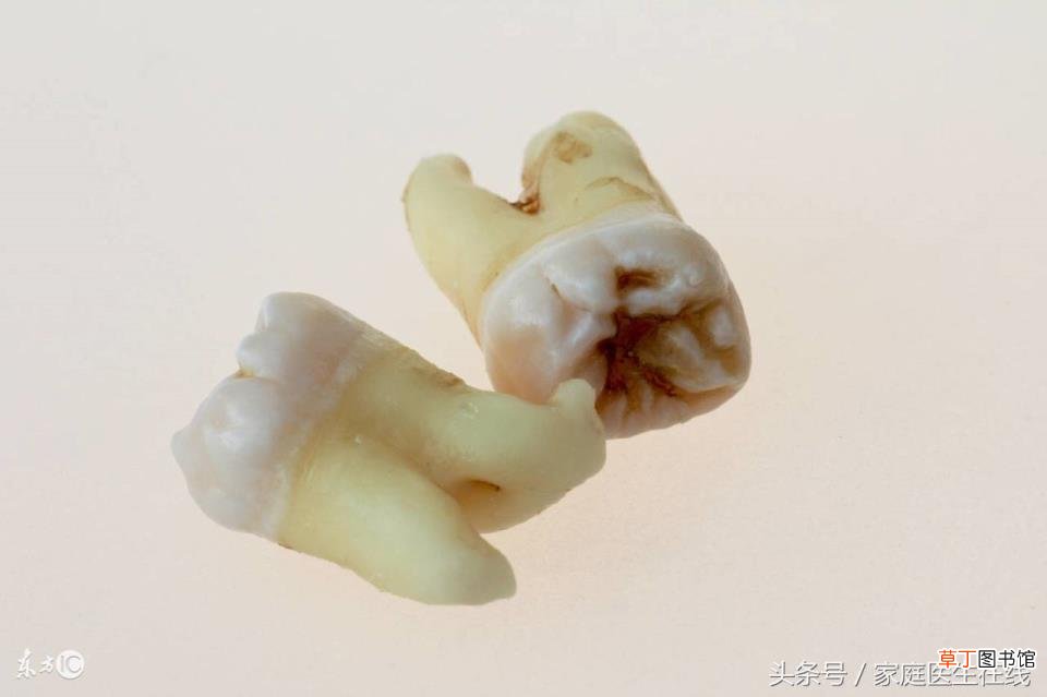 牙缝疙瘩可以扎破吗 为什么牙缝越来越大