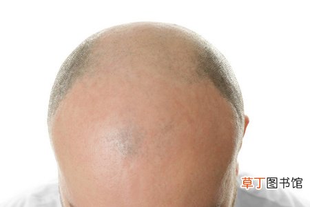 梦见自己剃了一半光头什么意思