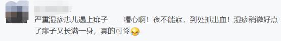 小儿干性湿疹 宝宝为什么干性湿疹