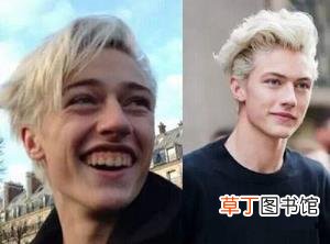 牙龈外露是什么原因造成的 为什么露牙龈