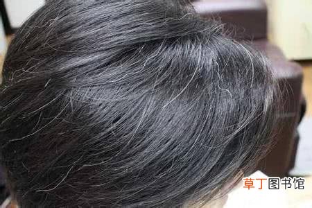 梦见白头发什么意思