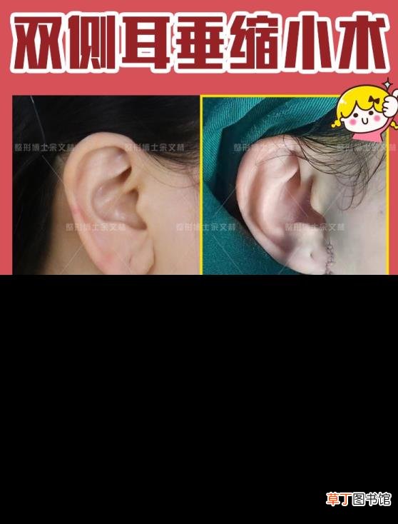 小孩耳朵老是裂怎么办 为什么耳朵裂