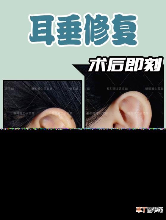 小孩耳朵老是裂怎么办 为什么耳朵裂