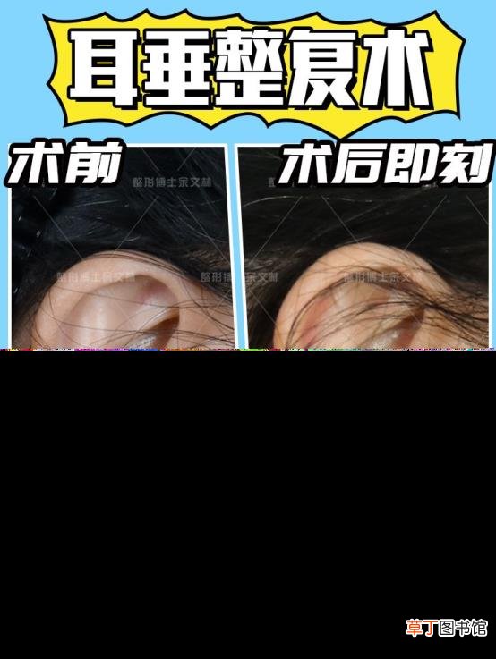 小孩耳朵老是裂怎么办 为什么耳朵裂