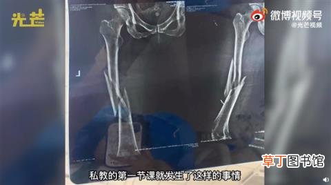 女子瑜伽馆学习瑜伽！第一次上私教课却被老师压断大腿：粉碎性骨折