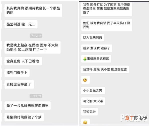 除疤产品 有哪些好用的祛疤膏
