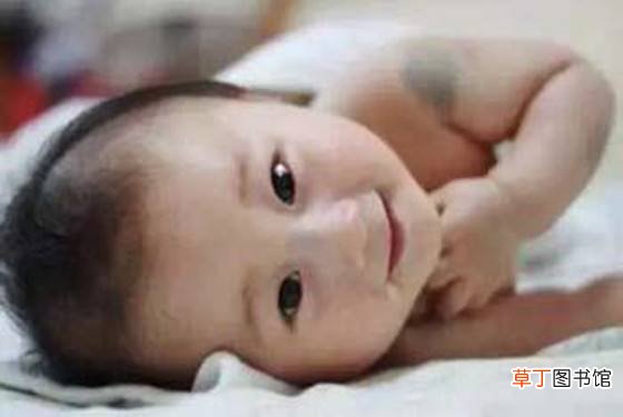 屁股胎记寓意着什么