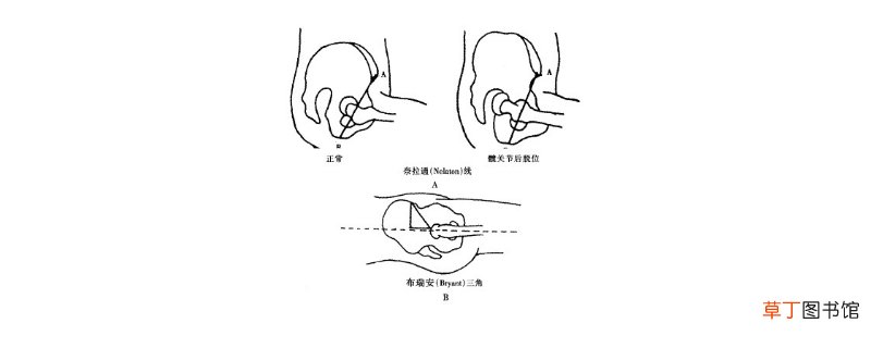 Bryant三角-生活百科知识