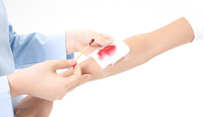 梦见自己受伤流血是什么意思 梦见自己受伤流血有什么预兆