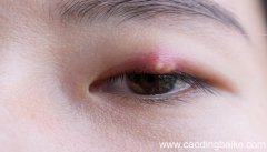梦见眼睛发红是什么意思 梦见眼睛发红有什么预兆