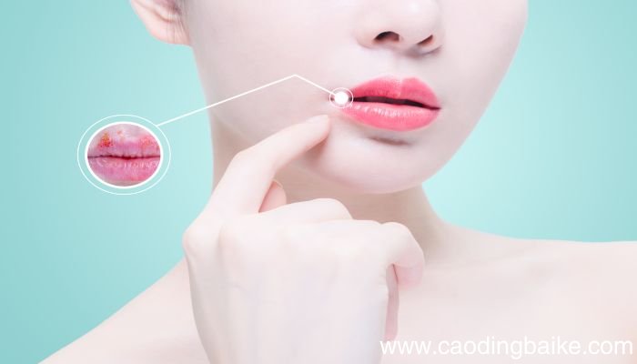 梦见溃疡是什么意思 梦见溃疡是什么预兆