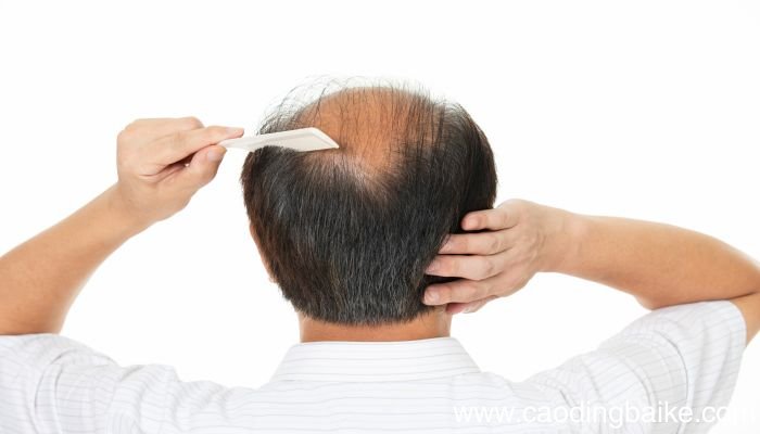 梦见担心丈夫掉头发什么意思 梦见担心丈夫掉头发预示什么