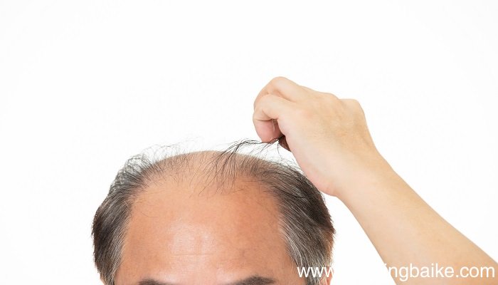 梦见秃头什么意思 梦见秃头预示什么