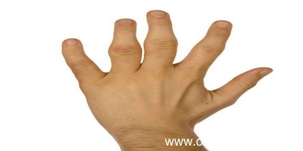 手指关节疼痛的原因