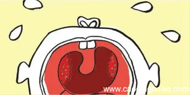 咽喉炎吃什么好的快