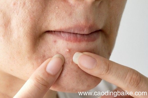 金盏花爽肤水有什么用 科颜氏金盏花爽肤水的作用