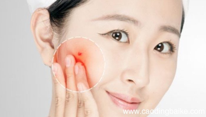 长期不去角质会怎样长期不去角质有问题吗