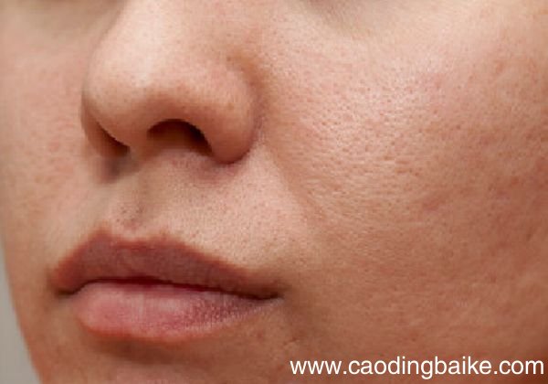 黄瓜面膜有哪些功效 黄瓜面膜的作用