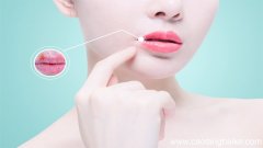 嘴巴干裂出血该如何解决 嘴巴干裂出血怎么办