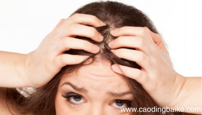 用生姜擦头皮能生发吗用生姜擦头皮有生发效果吗