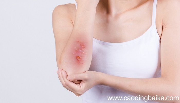 修复膏的功效和作用 修复膏怎么用