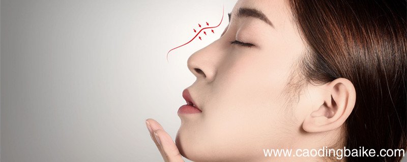 蒜头鼻和肉鼻子的图片区别 蒜头鼻和肉鼻子的区别