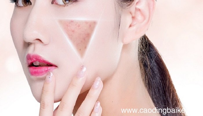 敷尔佳面膜适合哪些人