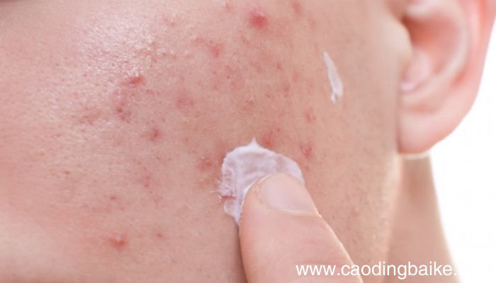 理肤泉k乳和duo的区别 理肤泉k乳和duo可以一起使用吗