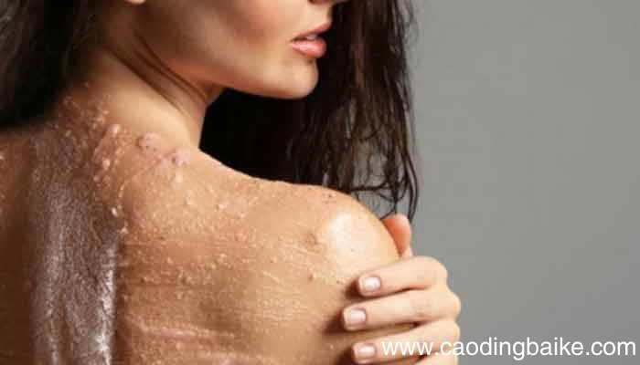 背部油性皮肤怎么改善背部油性皮肤如何改善