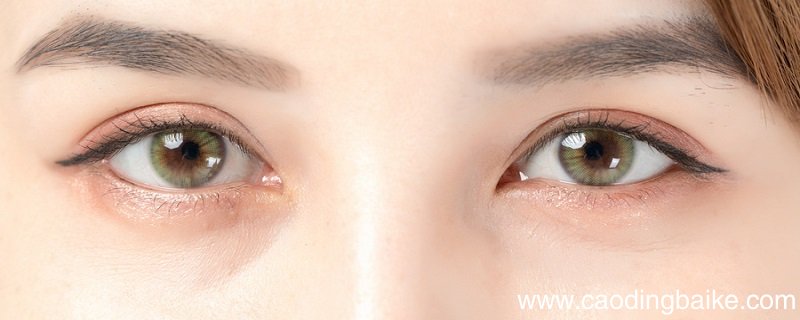 眼周肌肤松弛怎么办 眼部肌肤松弛怎么办