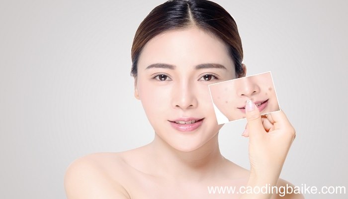 如何用白葡萄酒制作爽肤水 白葡萄酒制作爽肤水的好处