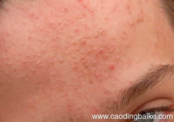 气垫BB用洗面奶可以洗掉吗 洗面奶卸BB霜的影响