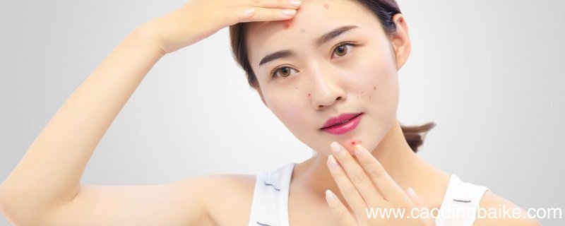 娇兰复原蜜是否可以祛痘印 娇兰精华和复原蜜怎么用