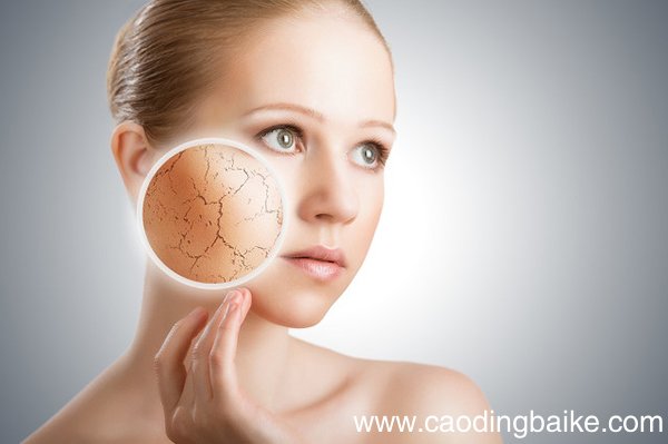 皮肤干燥起皮该怎么办 皮肤干燥起皮怎么治