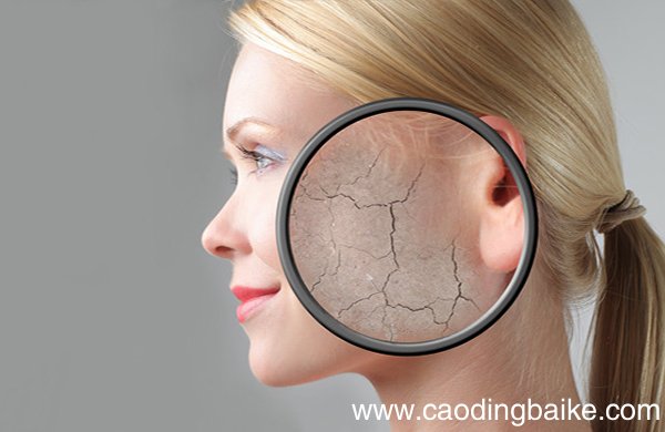 皮肤干燥起皮该怎么办 皮肤干燥起皮怎么治