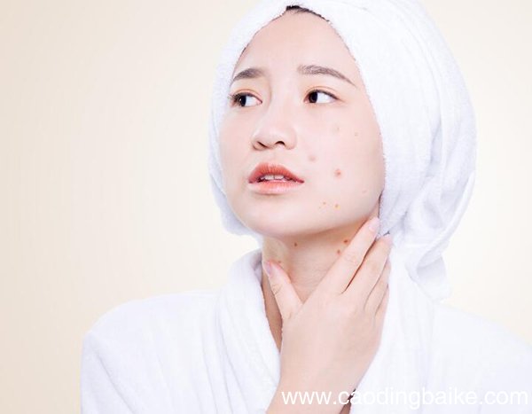 维生素e淡化痘印的方法 维生素e怎么淡化痘印